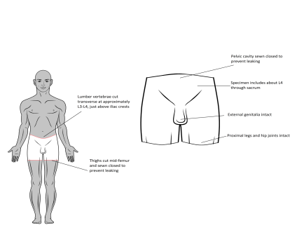 Quadril